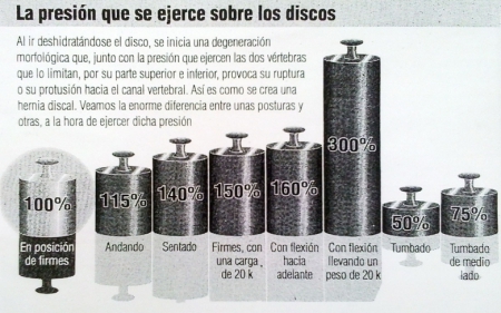 La carga sobre los discos invertebrales.