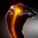 Prevención en el dolor de espalda